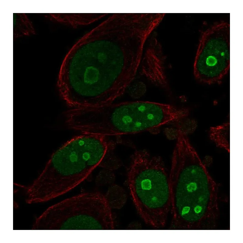 Atlas Antibodies Anti-BOP1 Antibody