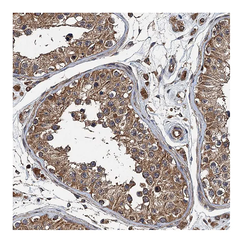 Atlas Antibodies Anti-BORCS5 Antibody