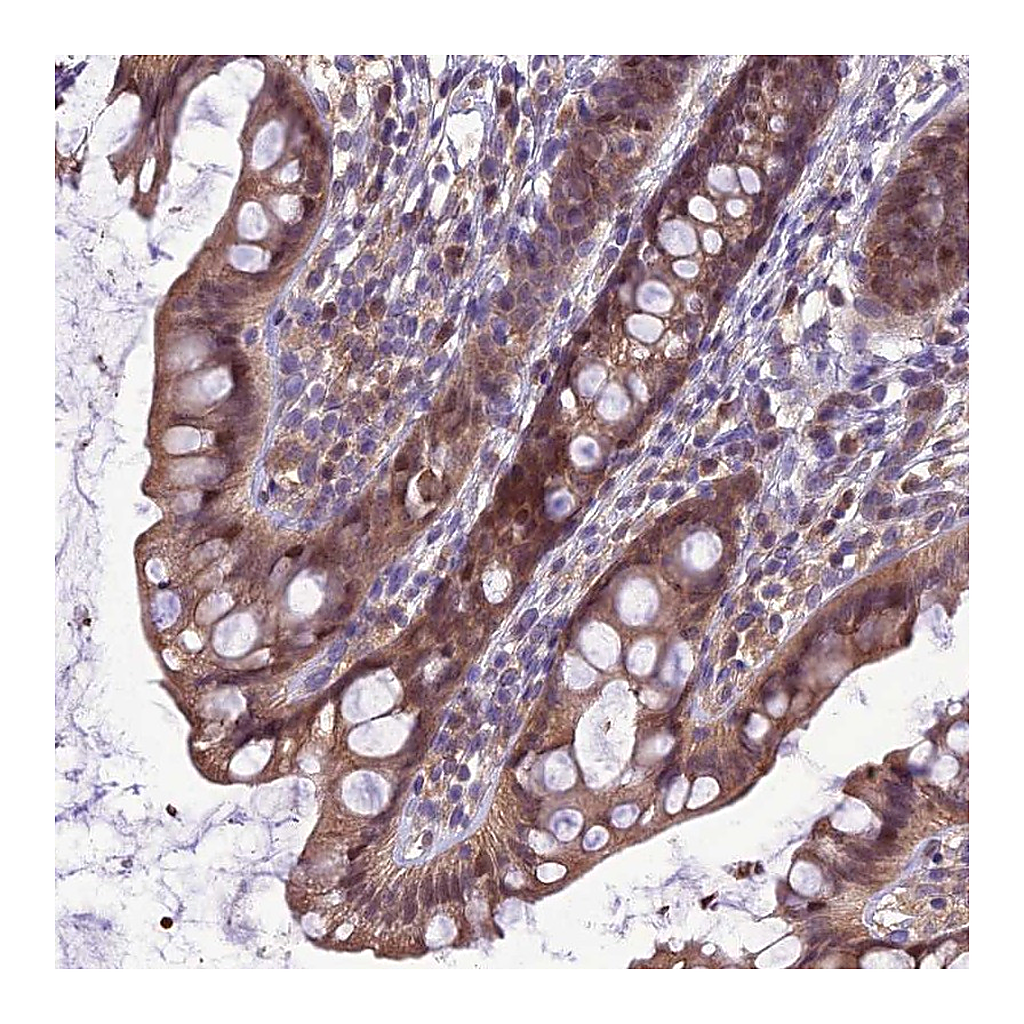 Atlas Antibodies Anti-BORCS6 Antibody