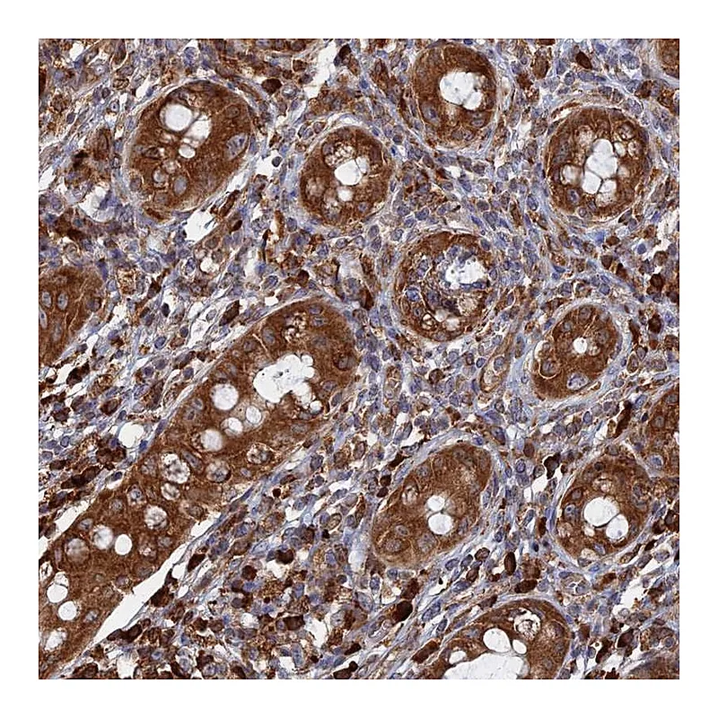 Atlas Antibodies Anti-BPIFB6 Antibody