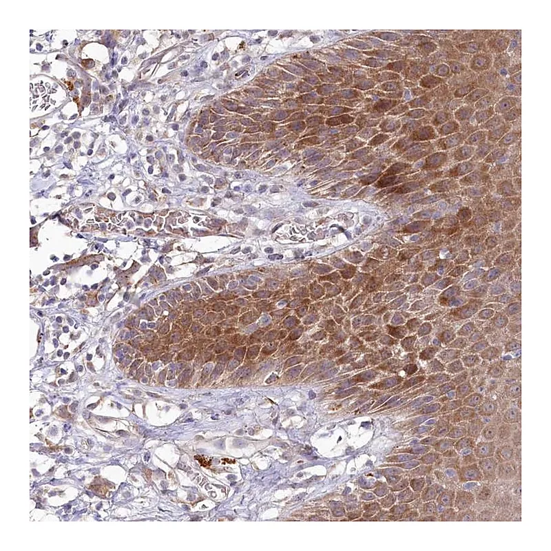 Atlas Antibodies Anti-BPIFC Antibody