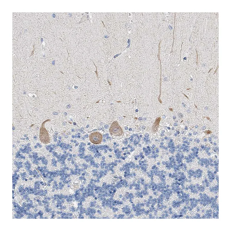 Atlas Antibodies Anti-BPTF Antibody