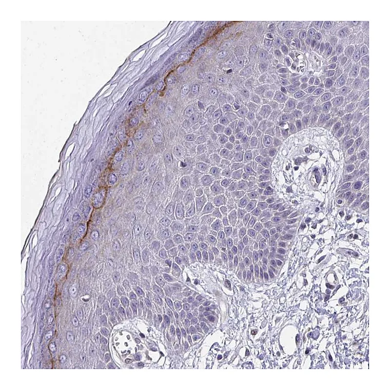 Atlas Antibodies Anti-BPIFC Antibody