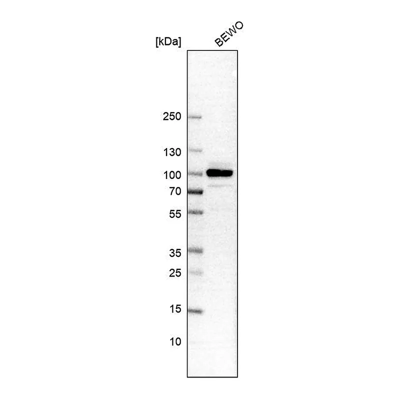Atlas Antibodies Anti-BRAF Antibody