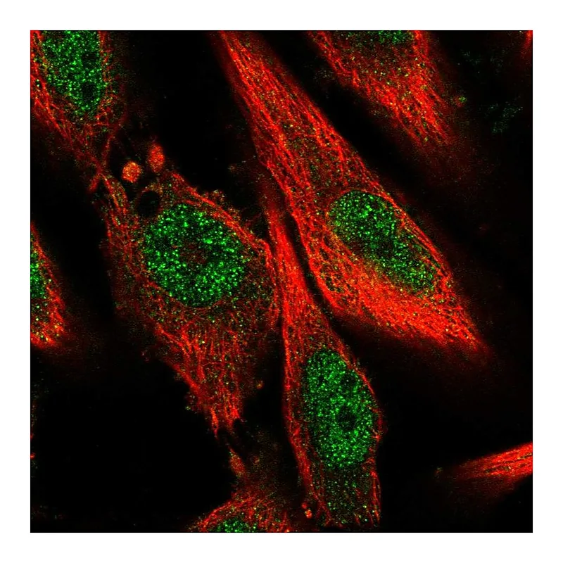 Atlas Antibodies Anti-BPTF Antibody