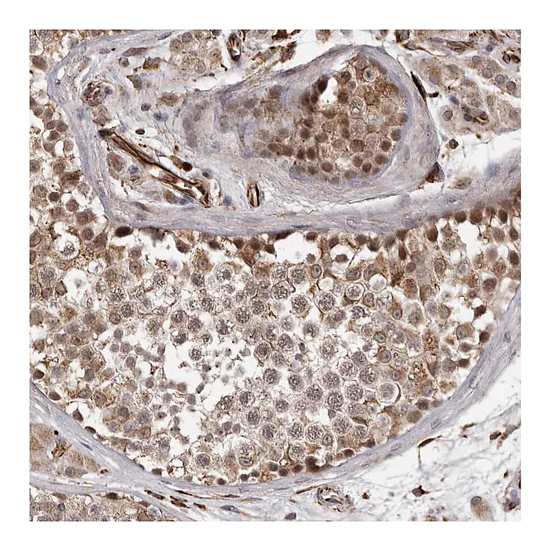 Atlas Antibodies Anti-BRAT1 Antibody