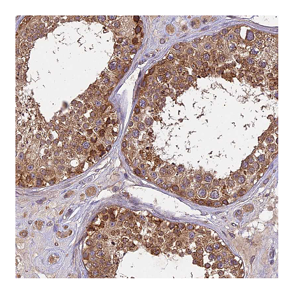 Atlas Antibodies Anti-BRAP Antibody