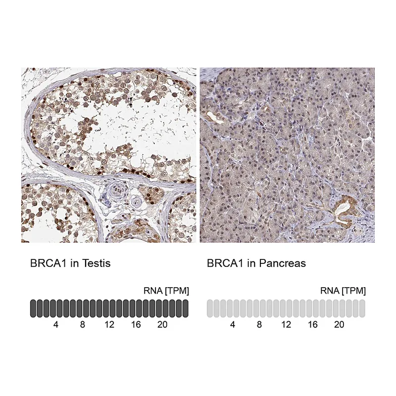 Atlas Antibodies Anti-BRCA1 Antibody