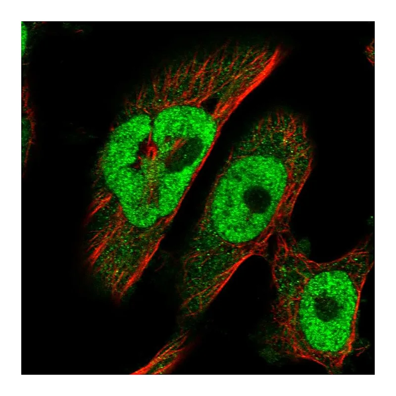 Atlas Antibodies Anti-BRCA2 Antibody