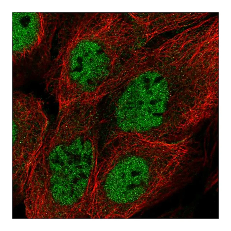 Atlas Antibodies Anti-BRCC3 Antibody