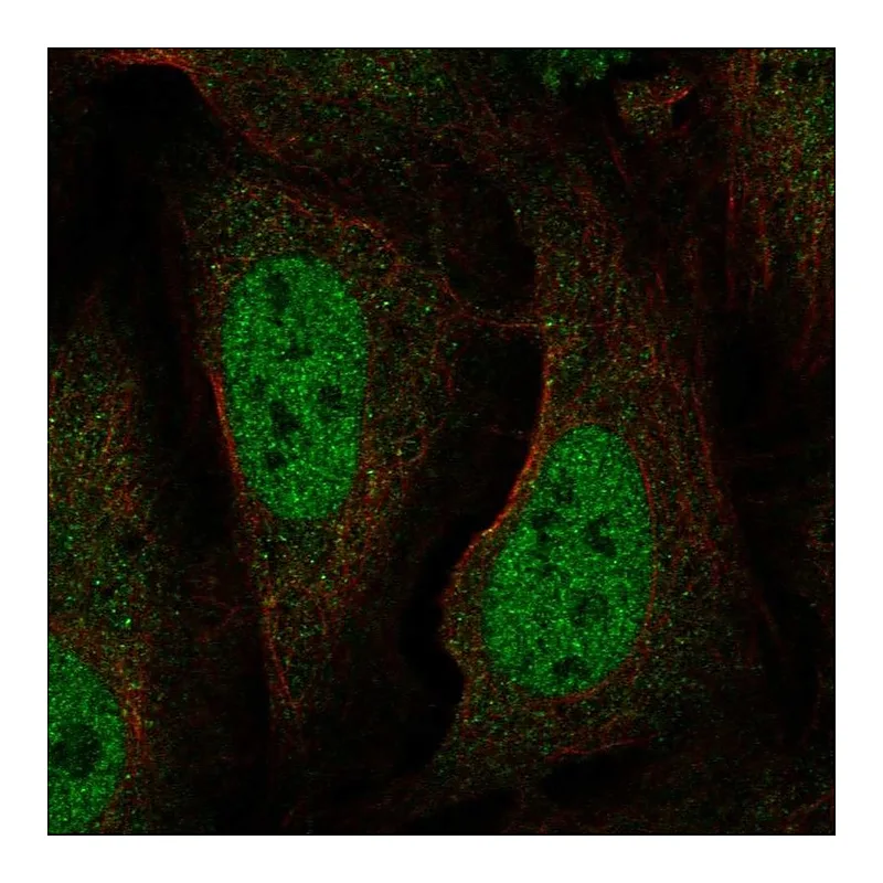 Atlas Antibodies Anti-BRAT1 Antibody