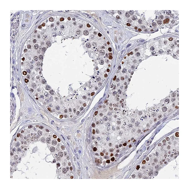 Atlas Antibodies Anti-BRD2 Antibody