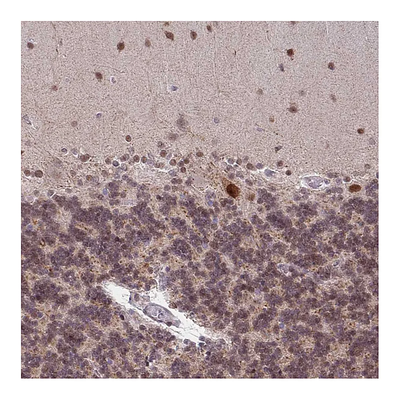 Atlas Antibodies Anti-BRD3 Antibody