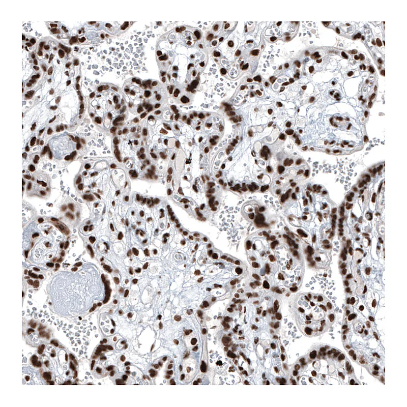 Atlas Antibodies Anti-BRD4 Antibody