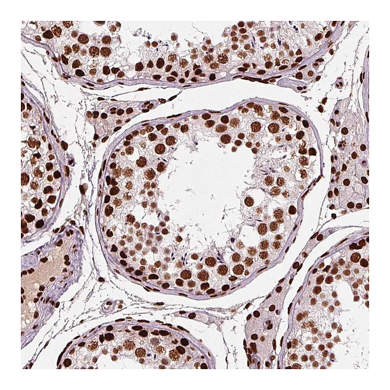 Atlas Antibodies Anti-BRD4 Antibody