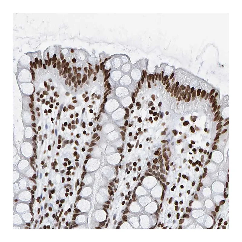 Atlas Antibodies Anti-BRF2 Antibody