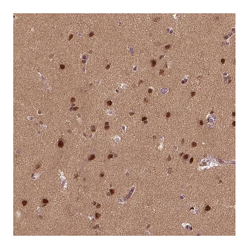 Atlas Antibodies Anti-BRD9 Antibody