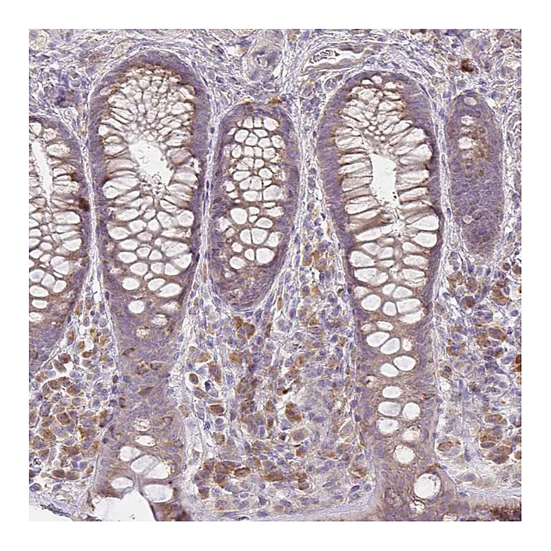 Atlas Antibodies Anti-BRINP3 Antibody