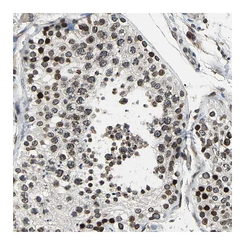 Atlas Antibodies Anti-BRIP1 Antibody