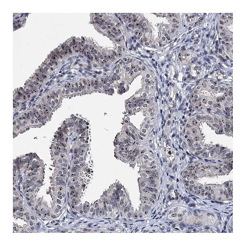 Atlas Antibodies Anti-BRIX1 Antibody