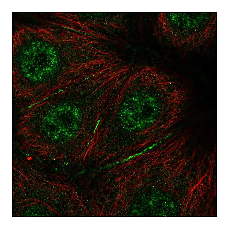 Atlas Antibodies Anti-BRK1 Antibody