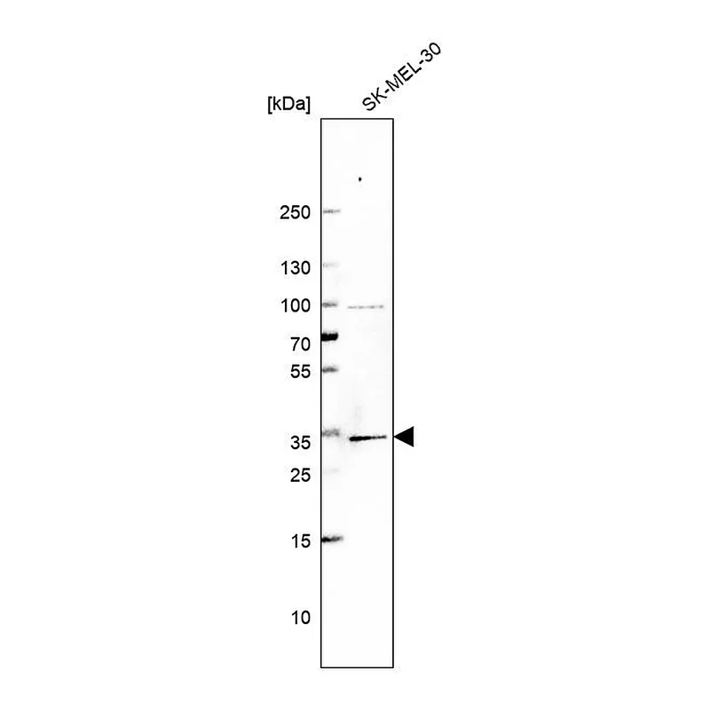 Atlas Antibodies Anti-BRMS1 Antibody