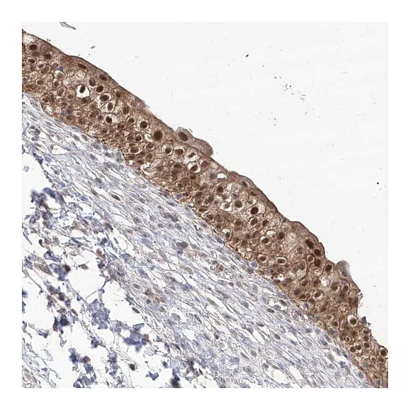 Atlas Antibodies Anti-BROX Antibody