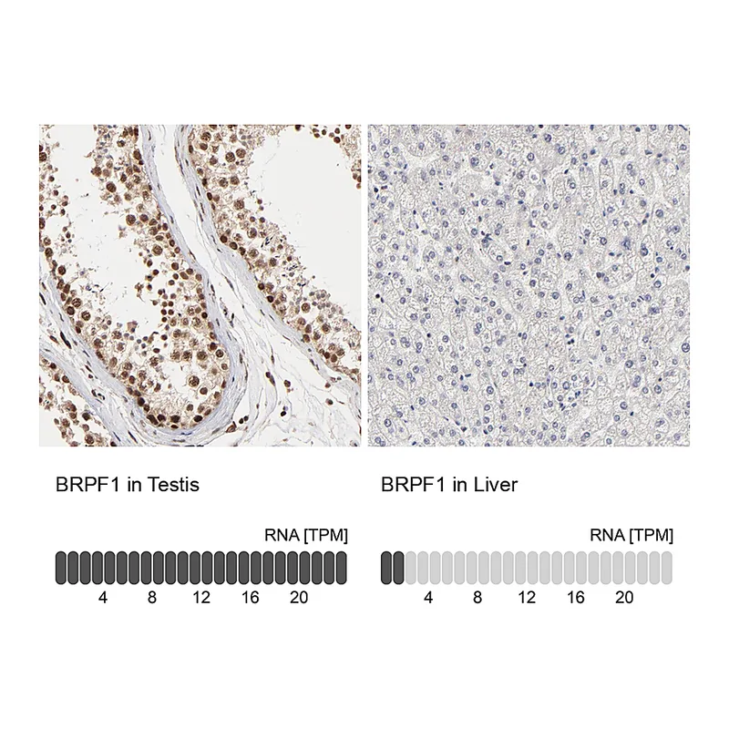 Atlas Antibodies Anti-BRPF1 Antibody