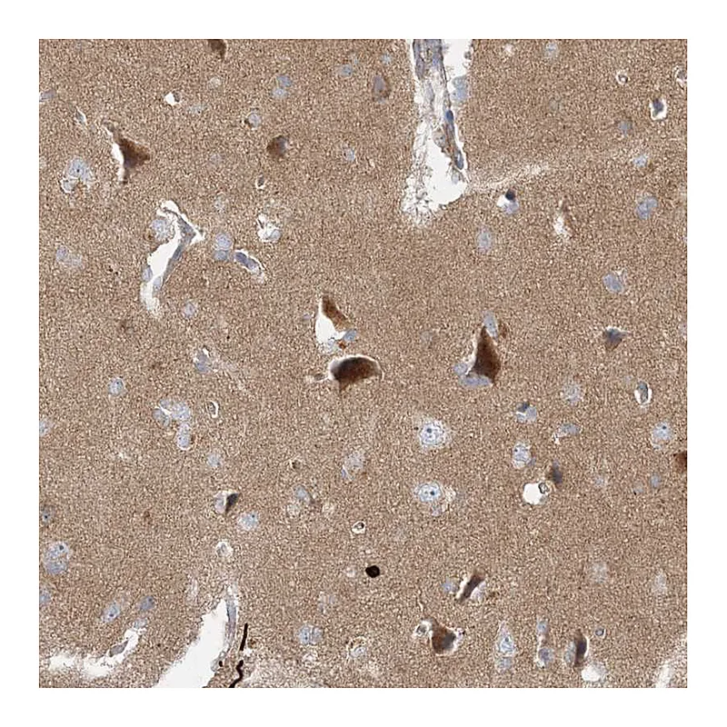 Atlas Antibodies Anti-BRWD1 Antibody