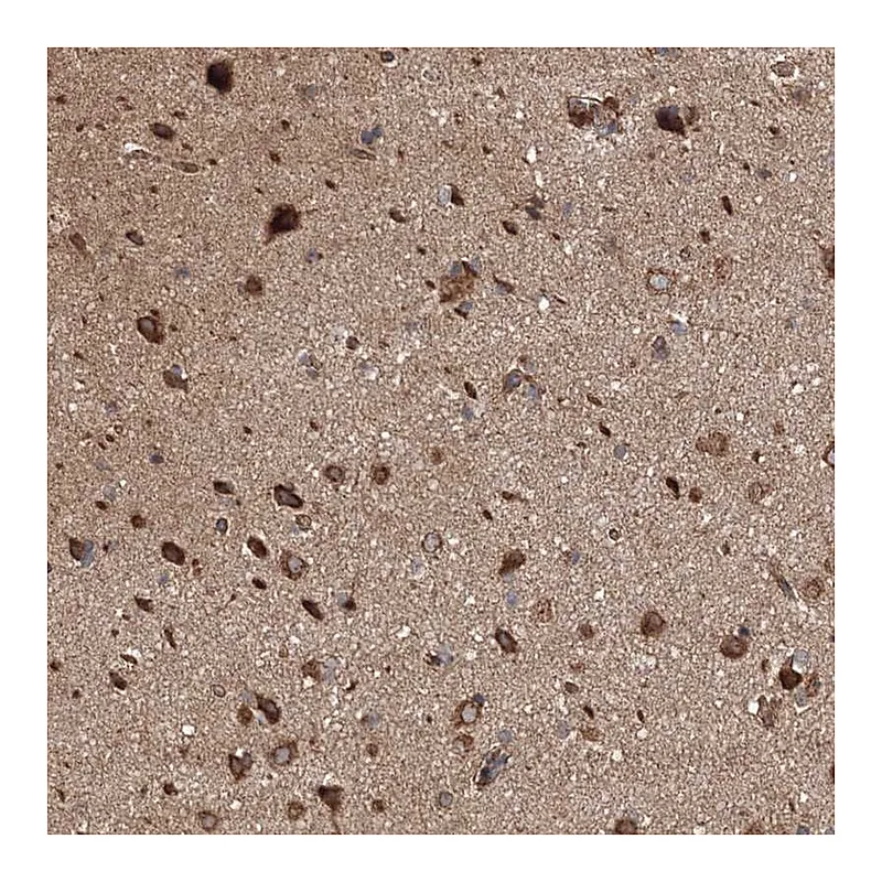 Atlas Antibodies Anti-BRWD1 Antibody