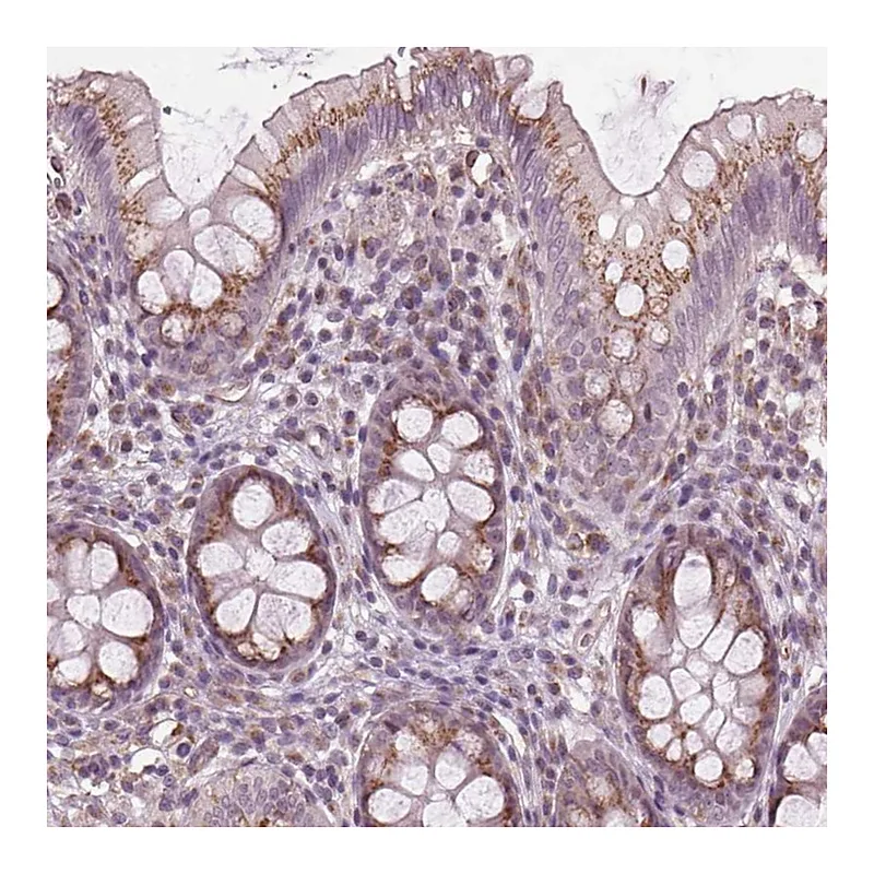 Atlas Antibodies Anti-BSDC1 Antibody