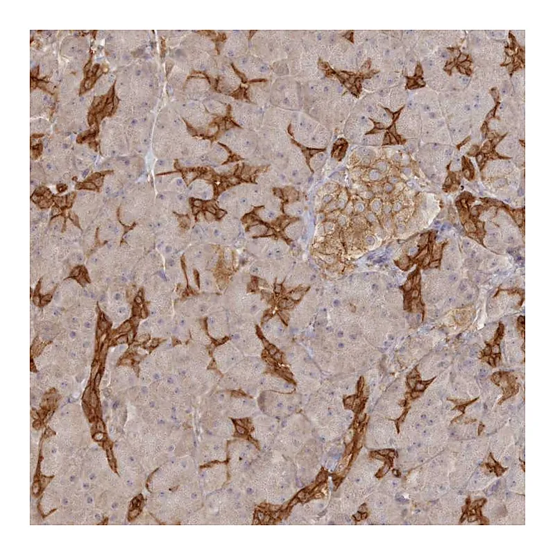 Atlas Antibodies Anti-BRWD1 Antibody