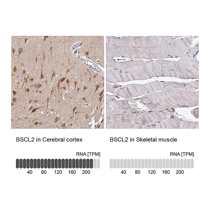 Atlas Antibodies Anti-BSCL2 Antibody