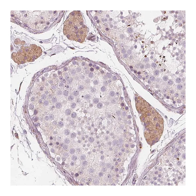 Atlas Antibodies Anti-BRSK1 Antibody