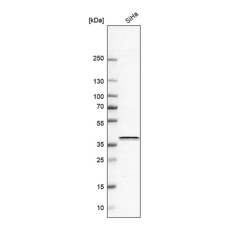 Atlas Antibodies Anti-BSG Antibody