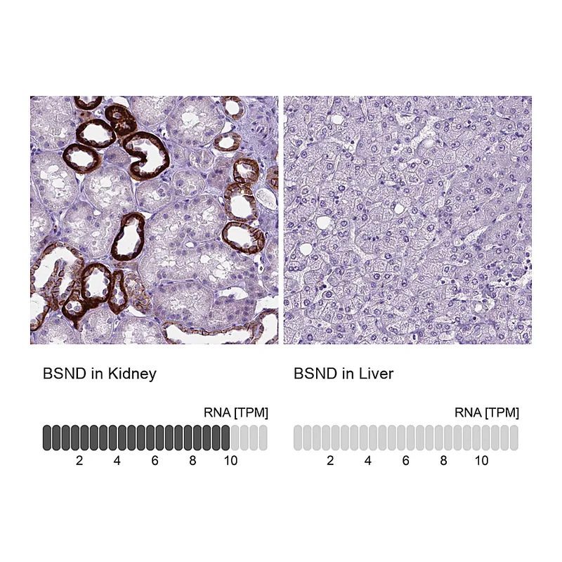 Atlas Antibodies Anti-BSND Antibody