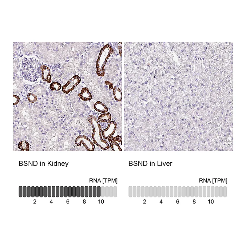 Atlas Antibodies Anti-BSND Antibody