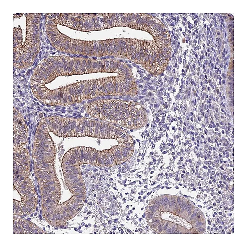 Atlas Antibodies Anti-BSPRY Antibody