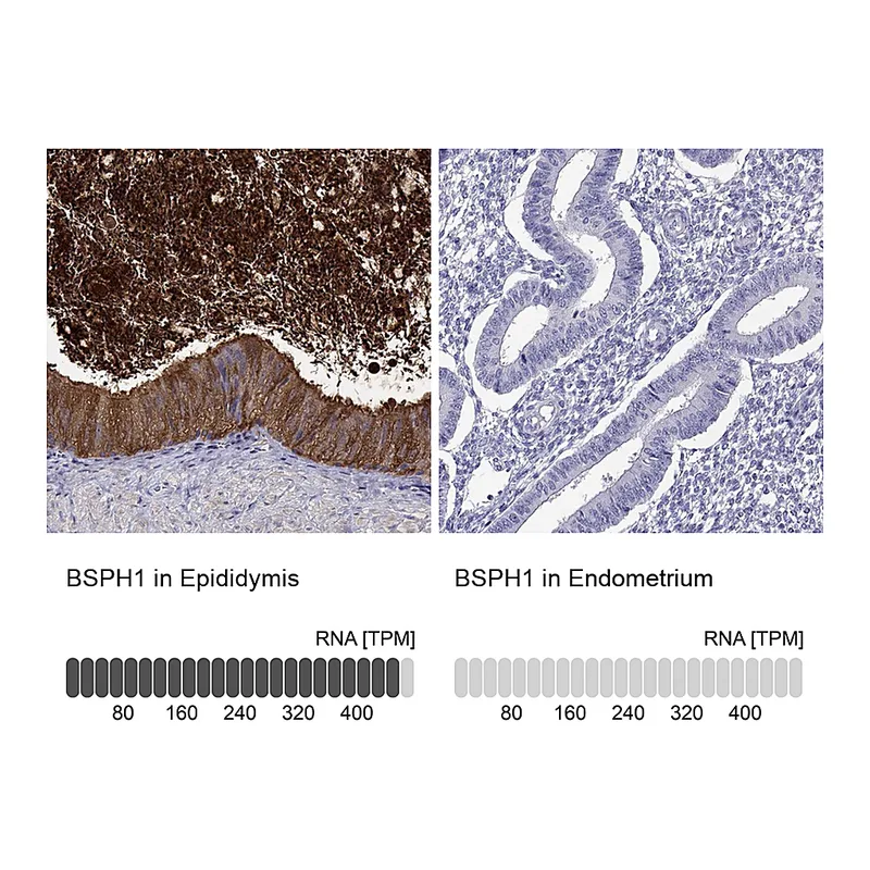 Atlas Antibodies Anti-BSPH1 Antibody