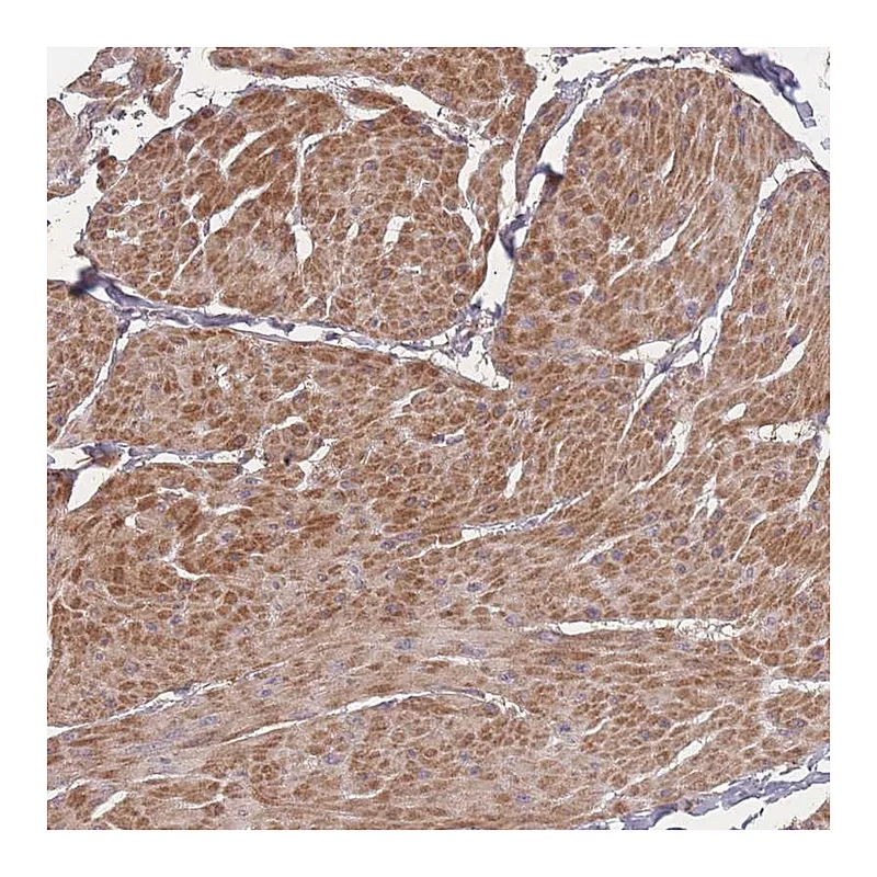 Atlas Antibodies Anti-BST1 Antibody