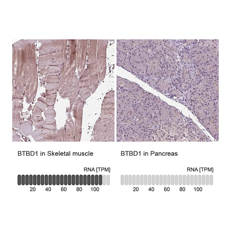 Atlas Antibodies Anti-BTBD1 Antibody