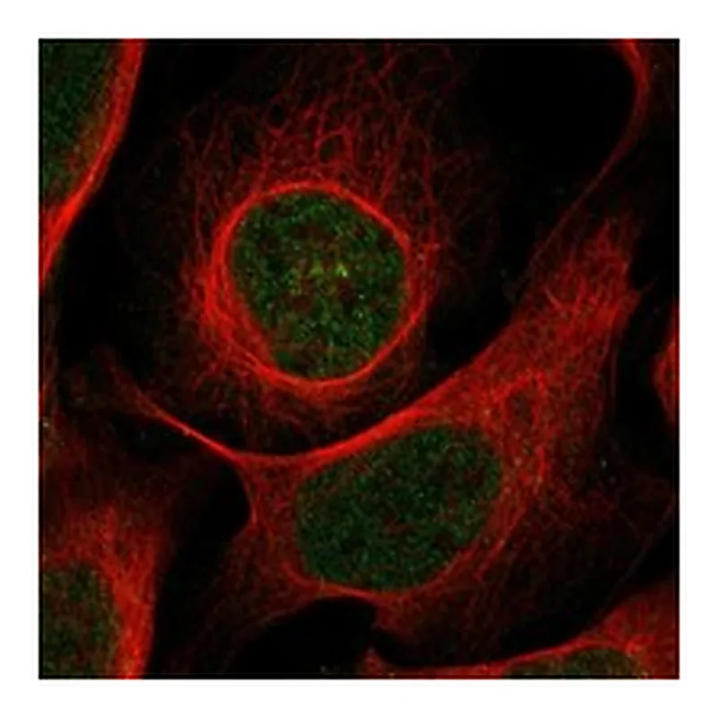 Atlas Antibodies Anti-BTBD11 Antibody