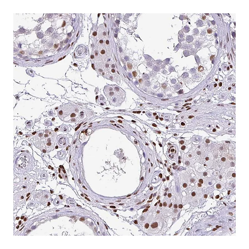 Atlas Antibodies Anti-BTBD10 Antibody