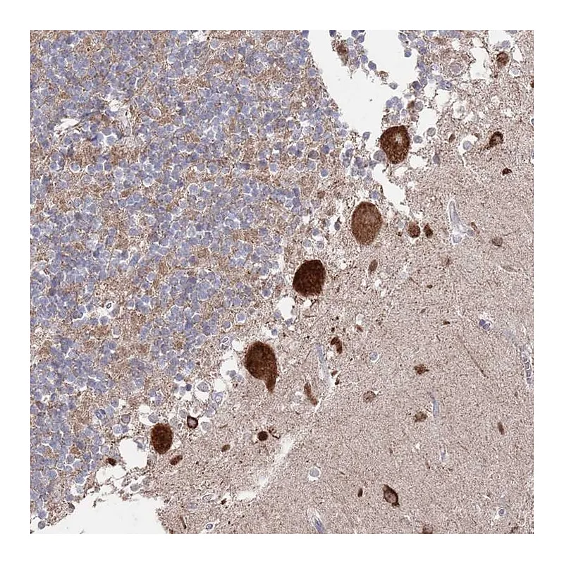 Atlas Antibodies Anti-BTBD18 Antibody