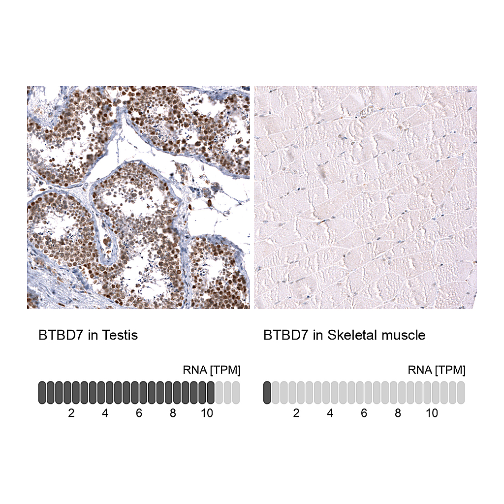 Atlas Antibodies Anti-BTBD7 Antibody
