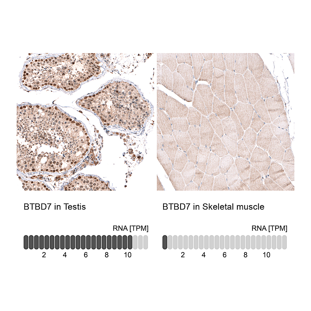 Atlas Antibodies Anti-BTBD7 Antibody