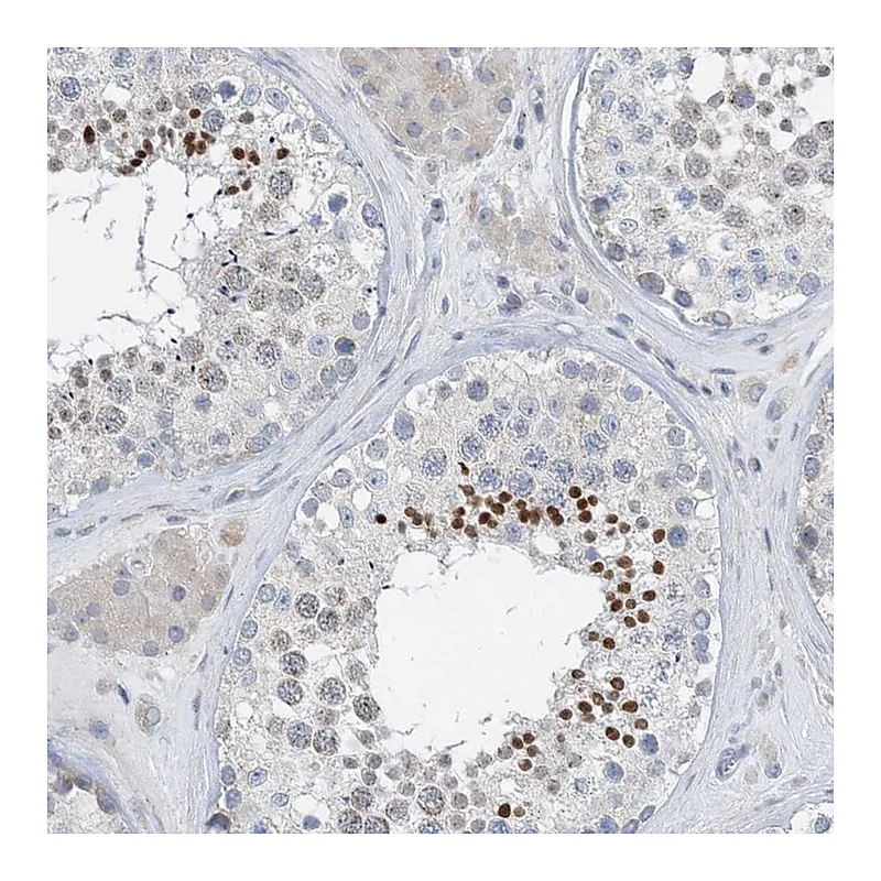 Atlas Antibodies Anti-BTBD8 Antibody