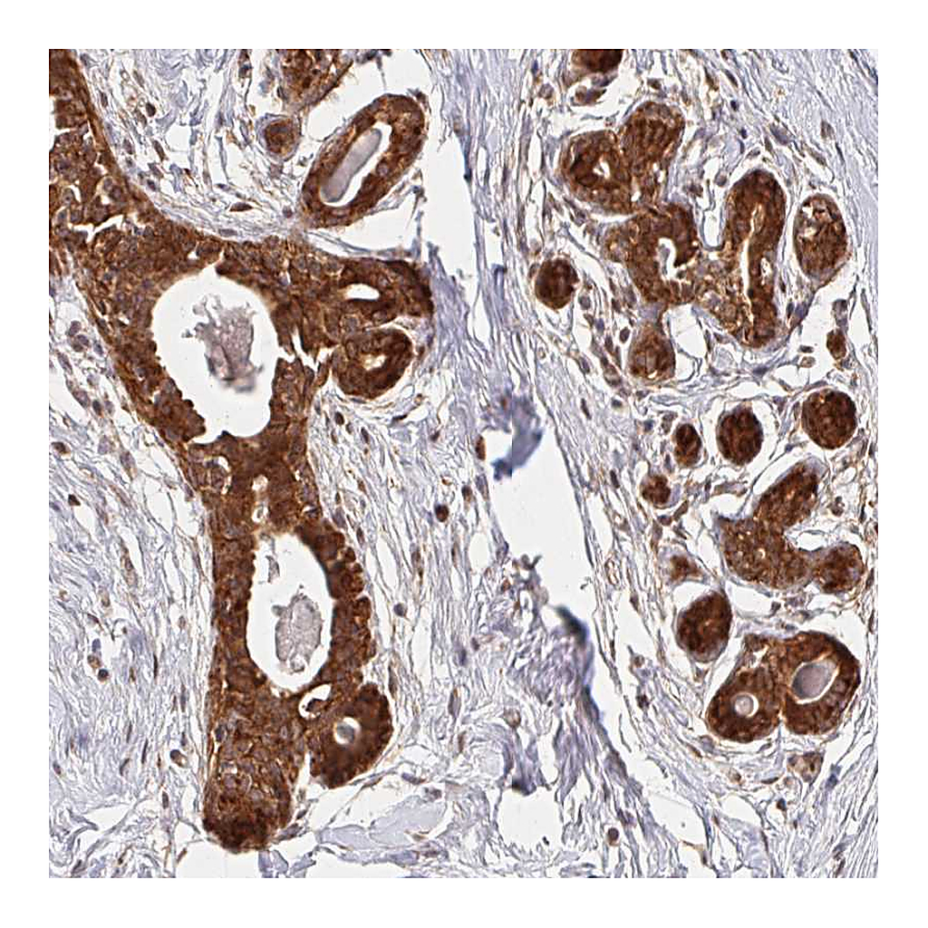 Atlas Antibodies Anti-BTF3 Antibody