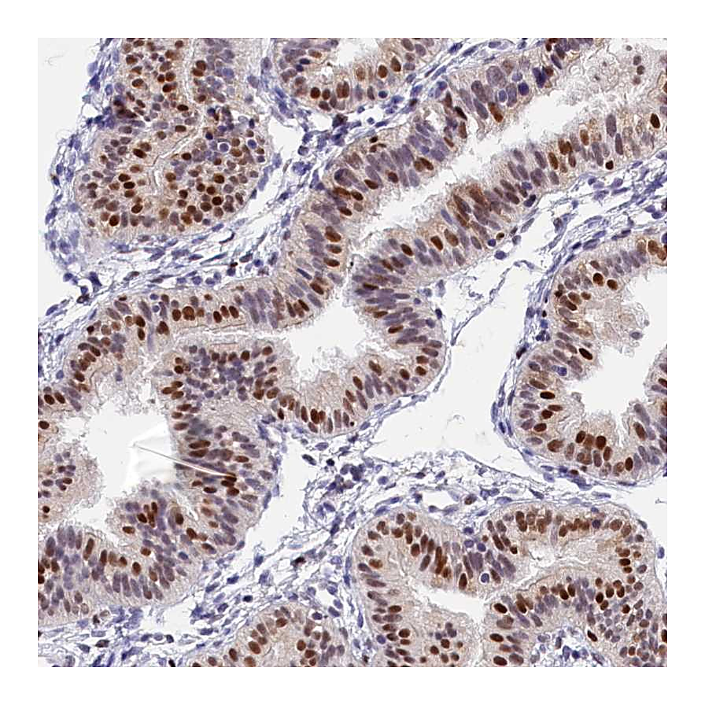 Atlas Antibodies Anti-BTBD9 Antibody