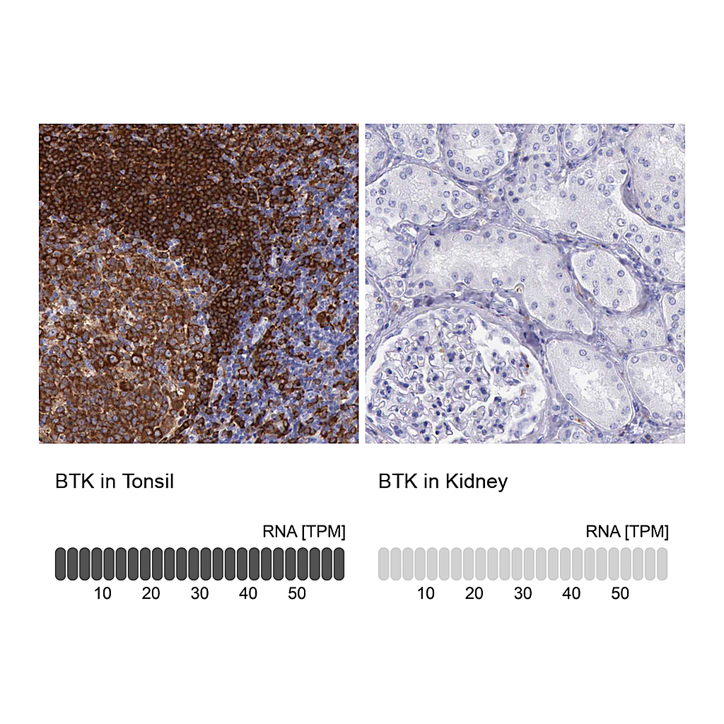 Atlas Antibodies Anti-BTK Antibody